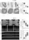 Fig. 11 - COMPOSITION AND METHODS FOR MODULATION OF ELOVL2