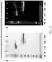 Fig. 17 - METHODS AND COMPOSITIONS RELATED TO IMPROVED FACTOR VIII LONG HALF-LIFE COAGULATION COMPLEXES