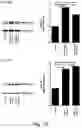 Fig. 20 - Modulation of proprotein convertase subtilisin/kexin 9 expression (PCSK9) with HSP 27 and/or HSP25
