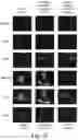 Fig. 21 - Modulation of proprotein convertase subtilisin/kexin 9 expression (PCSK9) with HSP 27 and/or HSP25