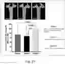 Fig. 25 - Modulation of proprotein convertase subtilisin/kexin 9 expression (PCSK9) with HSP 27 and/or HSP25