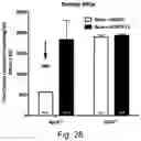 Fig. 32 - Modulation of proprotein convertase subtilisin/kexin 9 expression (PCSK9) with HSP 27 and/or HSP25