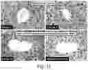 Fig. 35 - Modulation of proprotein convertase subtilisin/kexin 9 expression (PCSK9) with HSP 27 and/or HSP25
