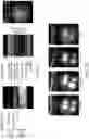 Fig. 02 - COMPOSITIONS AND METHODS FOR PREVENTING OR REDUCING INFLAMMATION BY INHIBITING CASPASE-9