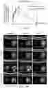 Fig. 13 - COMPOSITIONS AND METHODS FOR PREVENTING OR REDUCING INFLAMMATION BY INHIBITING CASPASE-9