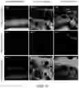 Fig. 21 - COMPOSITIONS AND METHODS FOR PREVENTING OR REDUCING INFLAMMATION BY INHIBITING CASPASE-9