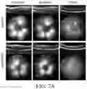 Fig. 23 - COMPOSITIONS AND METHODS FOR PREVENTING OR REDUCING INFLAMMATION BY INHIBITING CASPASE-9