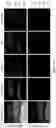 Fig. 32 - COMPOSITIONS AND METHODS FOR PREVENTING OR REDUCING INFLAMMATION BY INHIBITING CASPASE-9