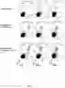 Fig. 18 - Combination of an immune checkpoint modulator and a complex comprising a cell penetrating peptide, a cargo and a TLR peptide agonist for use in medicine