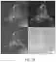 Fig. 03 - Methods of treatment using ultrasmall nanoparticles to induce cell death of nutrient-deprived cancer cells via ferroptosis