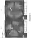 Fig. 06 - TXNIP AND LDHB COMPOSITIONS AND METHODS FOR THE TREATMENT OF DEGENERATIVE OCULAR DISEASES