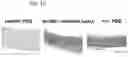Fig. 12 - COMPOSITIONS USEFUL IN TREATMENT OF KRABBE DISEASE