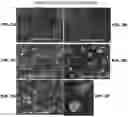 Fig. 04 - Methods and Compositions for Treatment of Disorders and Diseases Involving RDH12