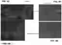 Fig. 09 - Methods and Compositions for Treatment of Disorders and Diseases Involving RDH12