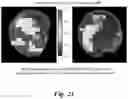 Fig. 22 - ADHESIVE/ADSORPTION SWITCH ON NANOPARTICLES TO INCREASE TUMOR UPTAKE AND DELAY TUMOR CLEARANCE