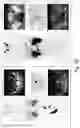 Fig. 31 - CANCER DIAGNOSTIC IMAGING AGENTS