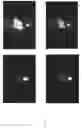 Fig. 14 - PROSTATE SPECIFIC MEMBRANE ANTIGEN (PSMA) LIGANDS WITH IMPROVED TISSUE SPECIFICITY