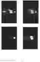 Fig. 17 - PROSTATE SPECIFIC MEMBRANE ANTIGEN (PSMA) LIGANDS WITH IMPROVED TISSUE SPECIFICITY