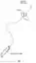 Fig. 06 - DEVICE TO PREVENT CATHETER ASSOCIATED URINARY TRACT INFECTION