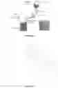 Fig. 14 - DEVICE TO PREVENT CATHETER ASSOCIATED URINARY TRACT INFECTION