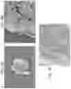 Fig. 10 - Particles comprising decellularized omentum