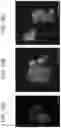 Fig. 11 - Particles comprising decellularized omentum