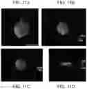 Fig. 12 - Particles comprising decellularized omentum