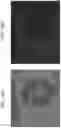 Fig. 13 - Particles comprising decellularized omentum