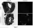 Fig. 08 - METHOD FOR BONE HEALING OR TREATMENT OF BONE FRACTURE