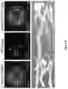 Fig. 09 - METHOD FOR BONE HEALING OR TREATMENT OF BONE FRACTURE