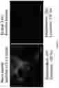 Fig. 20 - METHOD FOR BONE HEALING OR TREATMENT OF BONE FRACTURE
