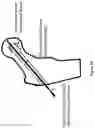 Fig. 26 - METHOD FOR BONE HEALING OR TREATMENT OF BONE FRACTURE