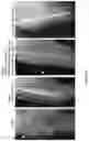 Fig. 28 - METHOD FOR BONE HEALING OR TREATMENT OF BONE FRACTURE