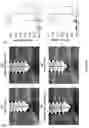 Fig. 29 - METHOD FOR BONE HEALING OR TREATMENT OF BONE FRACTURE