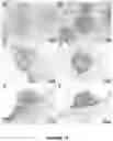 Fig. 09 - AN IMPLANTABLE DEVICE AND A METHOD FOR IMPLANTING SAID DEVICE IN A SUBJECT