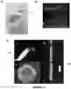 Fig. 10 - AN IMPLANTABLE DEVICE AND A METHOD FOR IMPLANTING SAID DEVICE IN A SUBJECT