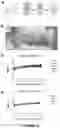 Fig. 15 - AN IMPLANTABLE DEVICE AND A METHOD FOR IMPLANTING SAID DEVICE IN A SUBJECT