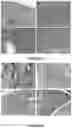 Fig. 17 - AN IMPLANTABLE DEVICE AND A METHOD FOR IMPLANTING SAID DEVICE IN A SUBJECT