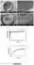Fig. 19 - AN IMPLANTABLE DEVICE AND A METHOD FOR IMPLANTING SAID DEVICE IN A SUBJECT