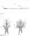 Fig. 03 - Urinary catheter