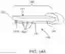 Fig. 19 - LAVAGE SYSTEMS AND DEVICES HAVING MULTIFUNCTIONAL APPLICATION MEMBER