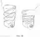 Fig. 03 - LAVAGE SYSTEMS AND DEVICES HAVING A VENTING COMPONENT