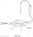 Fig. 11 - LAVAGE SYSTEMS AND DEVICES HAVING A VENTING COMPONENT