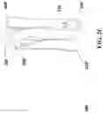 Fig. 06 - ENEMA DEVICE
