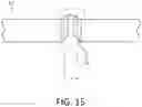 Fig. 16 - Intravenous fluid bag supporting assembly