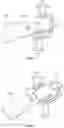 Fig. 04 - Bilaterally driven drug infusion device with multiple infusion modes