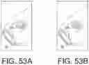 Fig. 100 - AUTO-INJECTOR AND RELATED METHODS OF USE