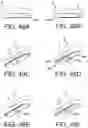 Fig. 94 - AUTO-INJECTOR AND RELATED METHODS OF USE
