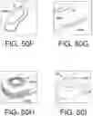 Fig. 96 - AUTO-INJECTOR AND RELATED METHODS OF USE