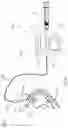 Fig. 04 - CATHETER INFLATABLE CUFF PRESSURE-SENSING DEVICES
